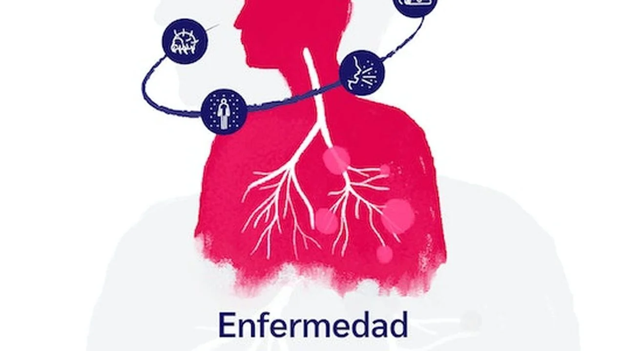Curso Gratis en español: Enfermedad respiratoria crónica. Asma – EPOC